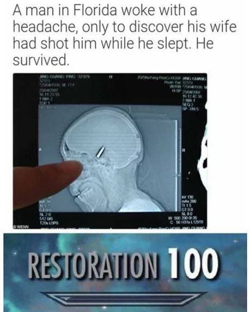 a man in florida woke with a headache, only to discover his wife had shot him while he slept.
